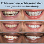 DentaGlow™ - Premium Tandenbleekset